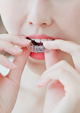 目立たない矯正治療